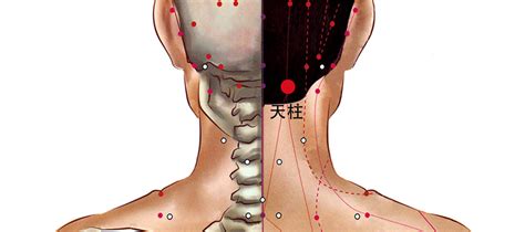 天柱穴氣結